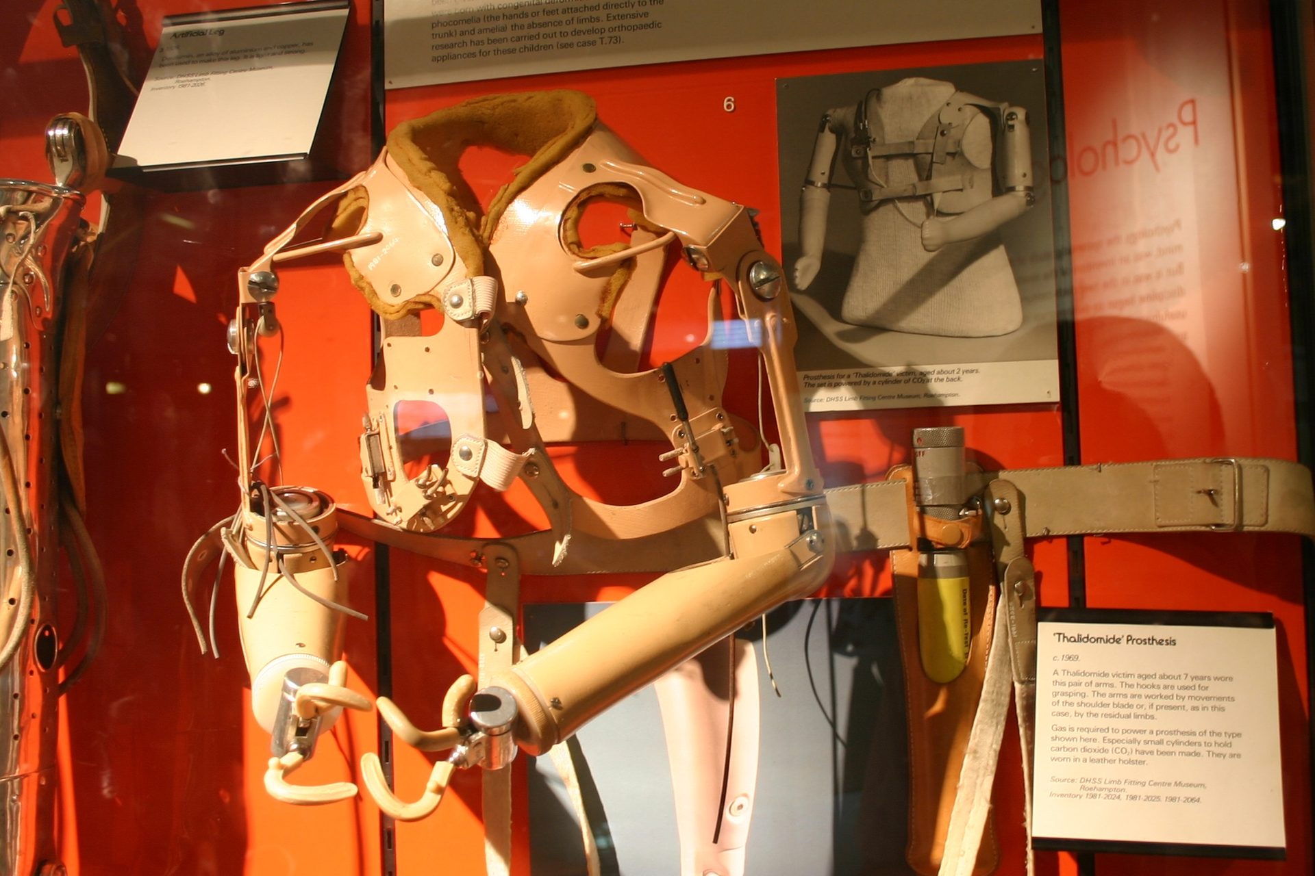 Appliances for Thalidomide victims, Science Museum, London - 02.JPG
